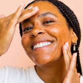 Model applying soothing face peel with AHA sensitive skin BKIND